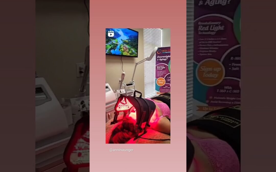 Video: Lip filler in Orange County 🍊 with @Anninetheesti