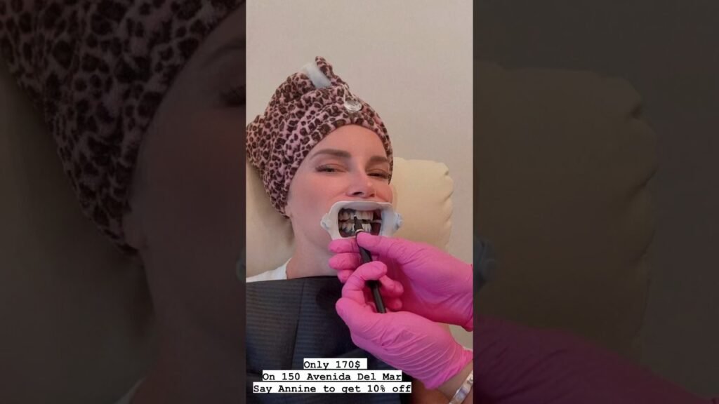 Teeth Whitening looks crazy! #teethwhitening #beauty #crazyvideo #holloween #beforeandafter