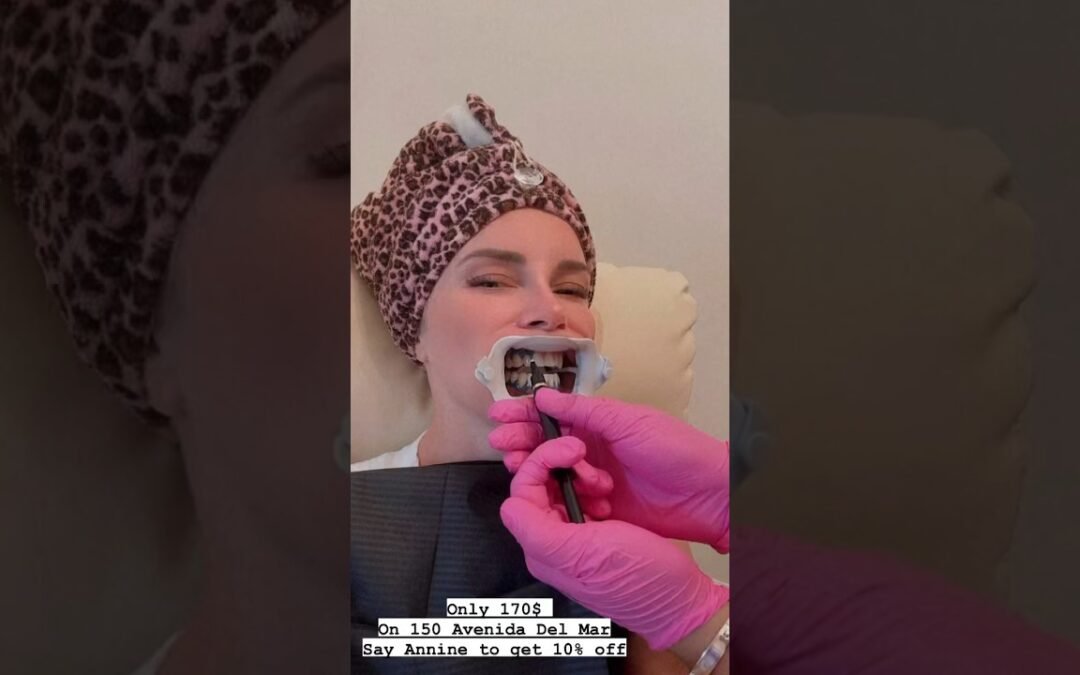 Video: Teeth Whitening looks crazy! #teethwhitening #beauty #crazyvideo #holloween #beforeandafter