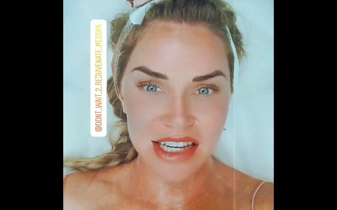 Video: Ultherapy in Orange County  @Anninetheesti